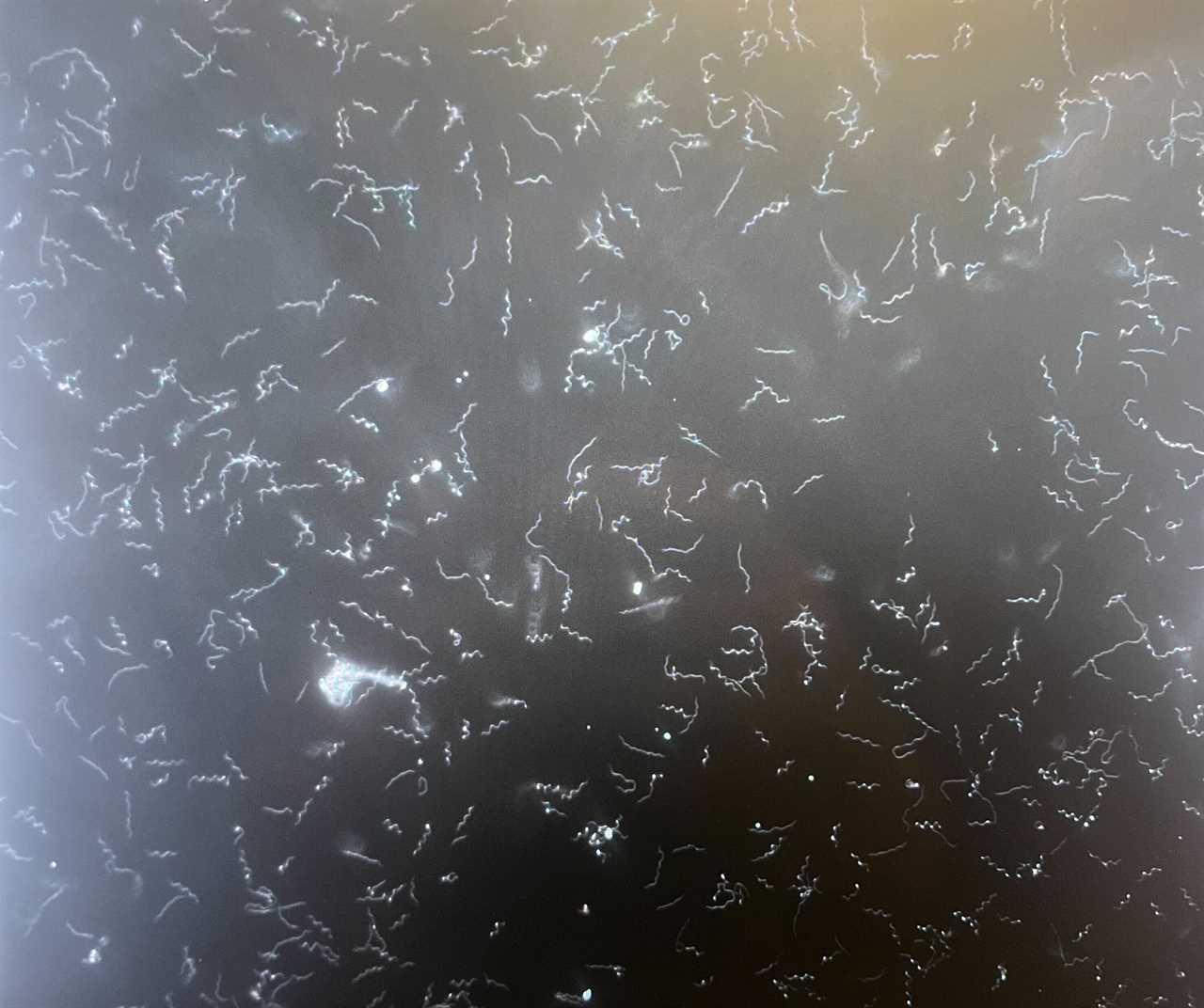 Scientists Have Identified the Lyme Disease Genes Responsible for Severe Symptoms