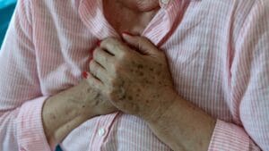 heart attack and sudden cardiac arrest